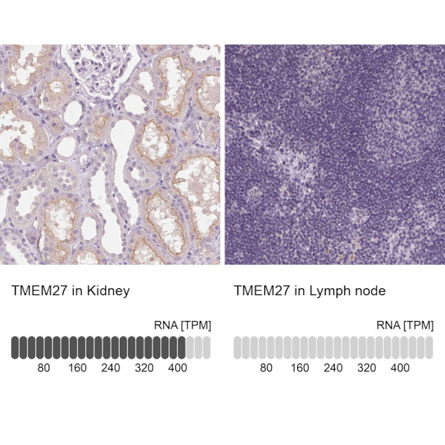 TMEM27 Antibody in Immunohistochemistry (IHC)