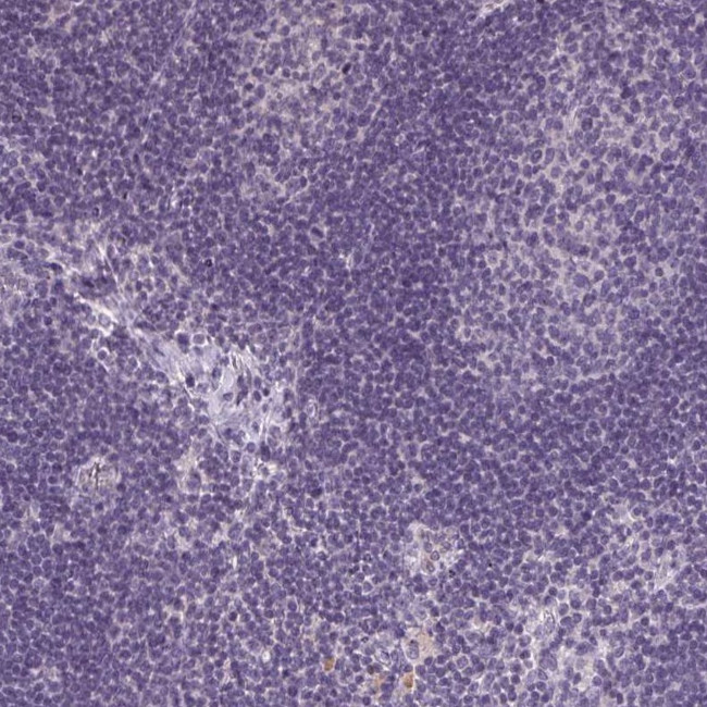 TMEM27 Antibody in Immunohistochemistry (IHC)