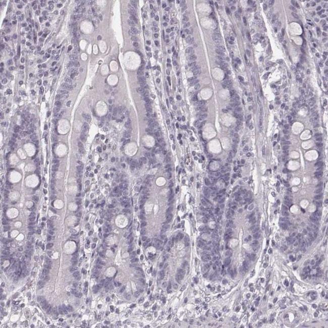 KRT74 Antibody in Immunohistochemistry (IHC)