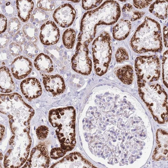 QTRT1 Antibody in Immunohistochemistry (IHC)