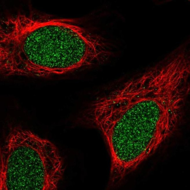 ZNF658 Antibody in Immunocytochemistry (ICC/IF)