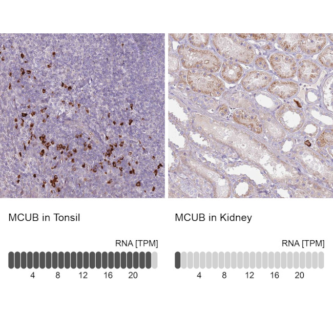 CCDC109B Antibody