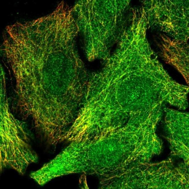 Det1 Antibody in Immunocytochemistry (ICC/IF)