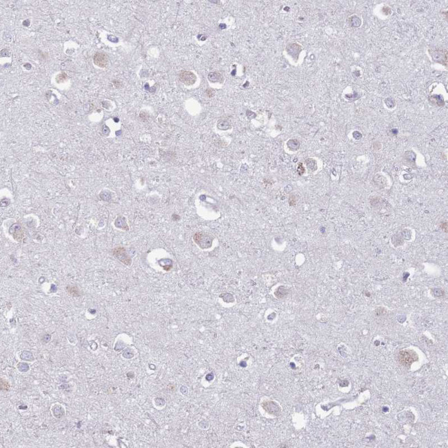 LTB Antibody in Immunohistochemistry (IHC)