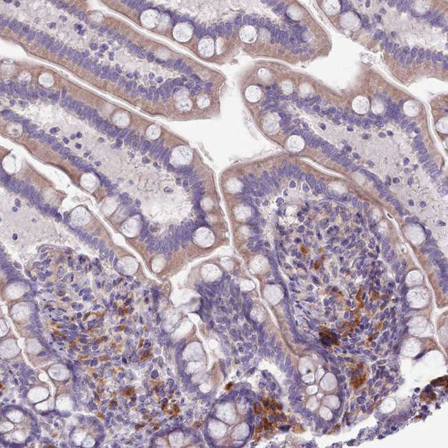 LTB Antibody in Immunohistochemistry (IHC)