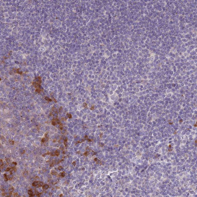 LTB Antibody in Immunohistochemistry (IHC)