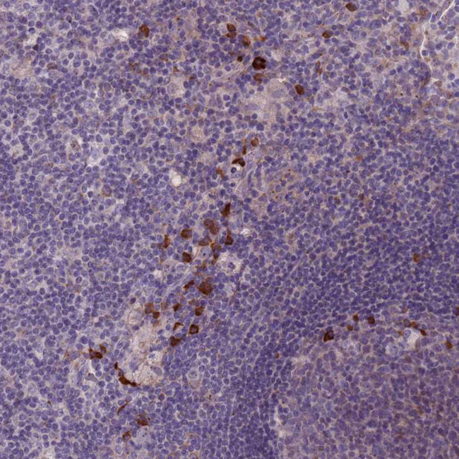 LTB Antibody in Immunohistochemistry (IHC)