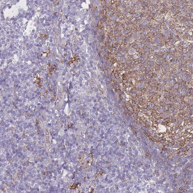 GNAQ Antibody in Immunohistochemistry (IHC)