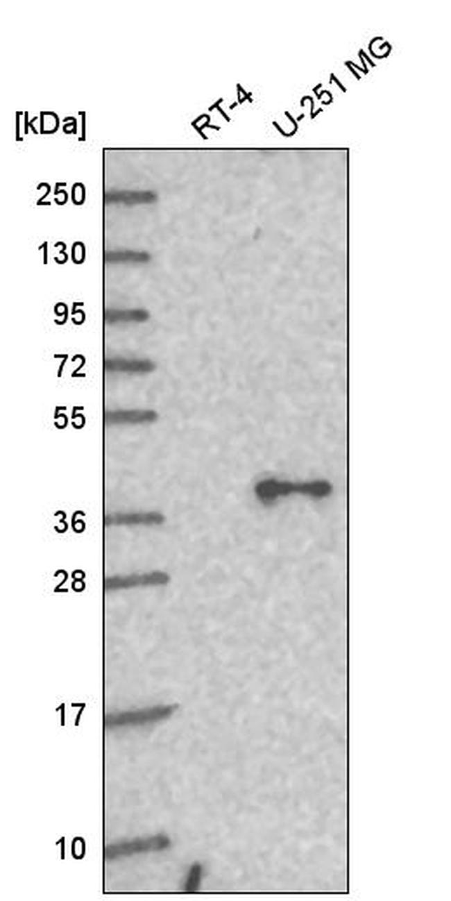 GNAQ Antibody in Western Blot (WB)