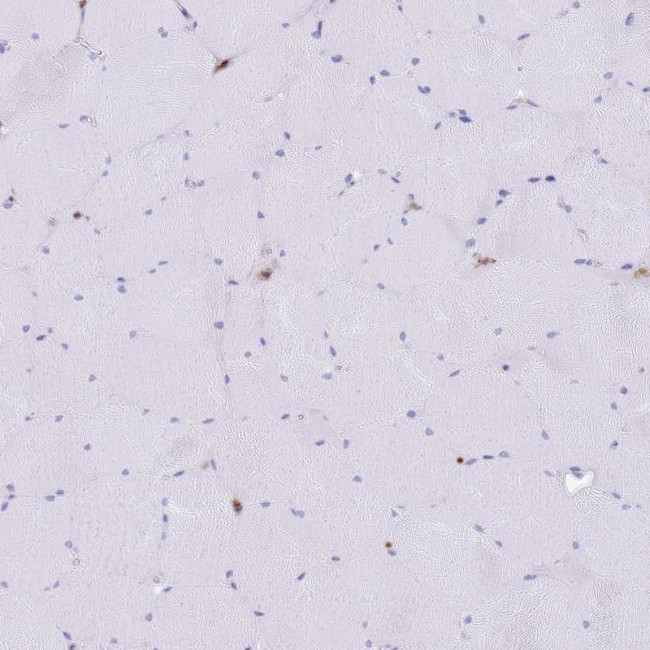 EFHD2 Antibody in Immunohistochemistry (IHC)