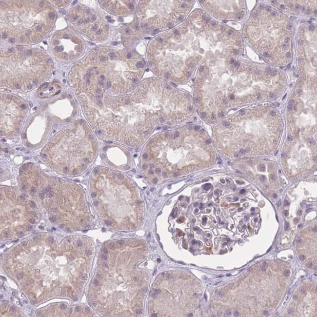 ZBTB24 Antibody in Immunohistochemistry (IHC)