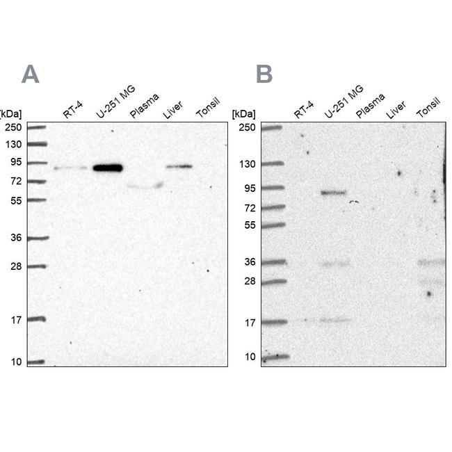 PLOD1 Antibody in Western Blot (WB)