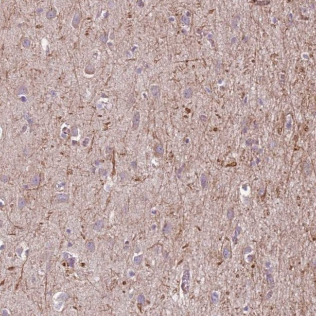 EGFL4 Antibody in Immunohistochemistry (IHC)