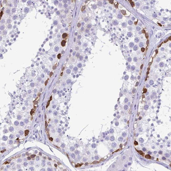 TSPY10 Antibody in Immunohistochemistry (IHC)