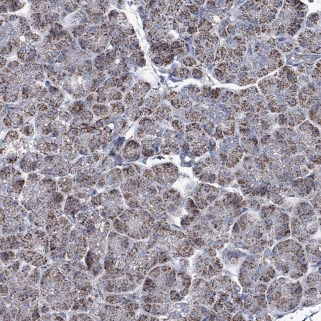 IDH3B Antibody in Immunohistochemistry (IHC)