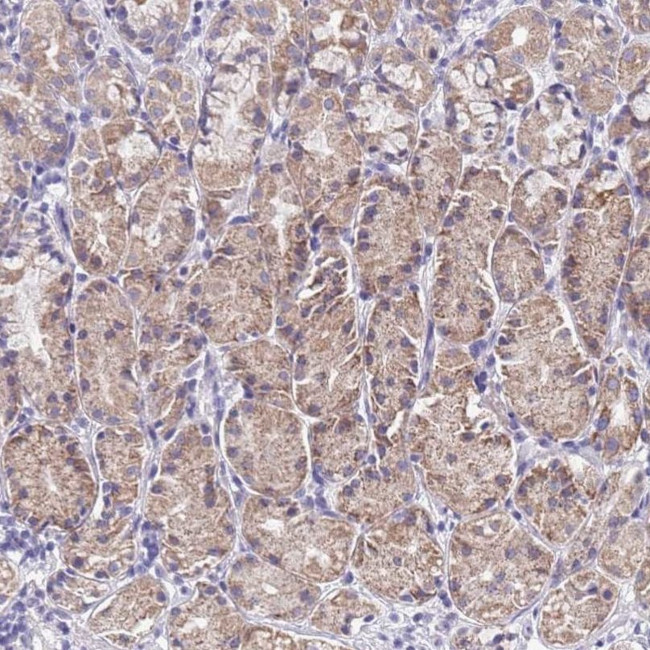 SPIRE2 Antibody in Immunohistochemistry (IHC)