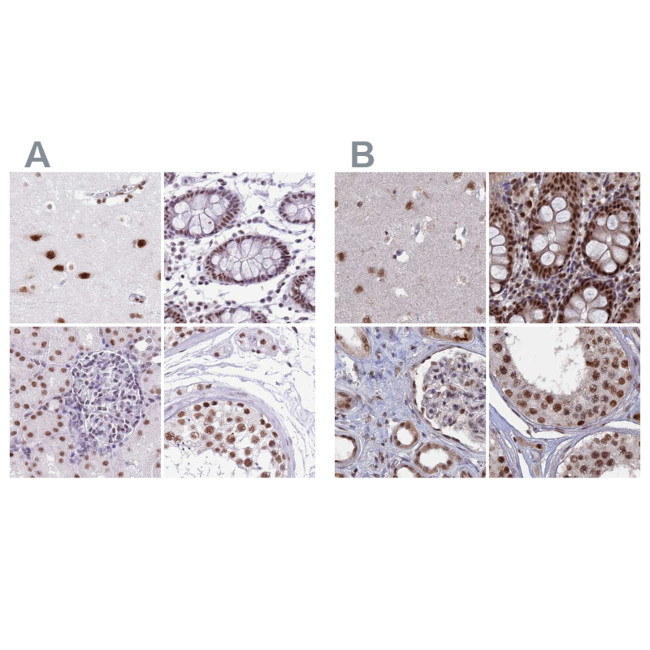 SF3A2 Antibody in Immunohistochemistry (IHC)