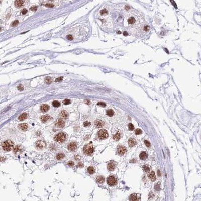 SF3A2 Antibody in Immunohistochemistry (IHC)