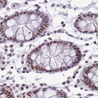 SF3A2 Antibody in Immunohistochemistry (IHC)