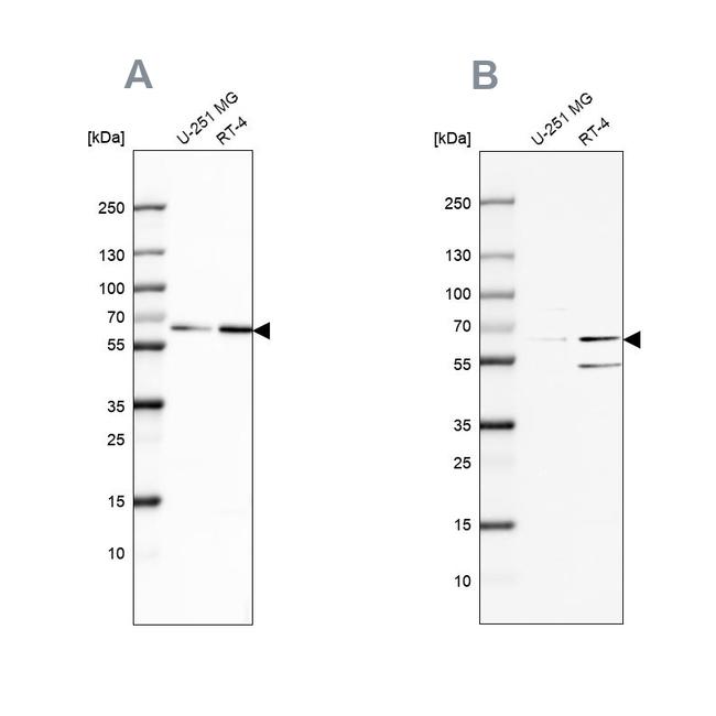 SF3A2 Antibody in Western Blot (WB)