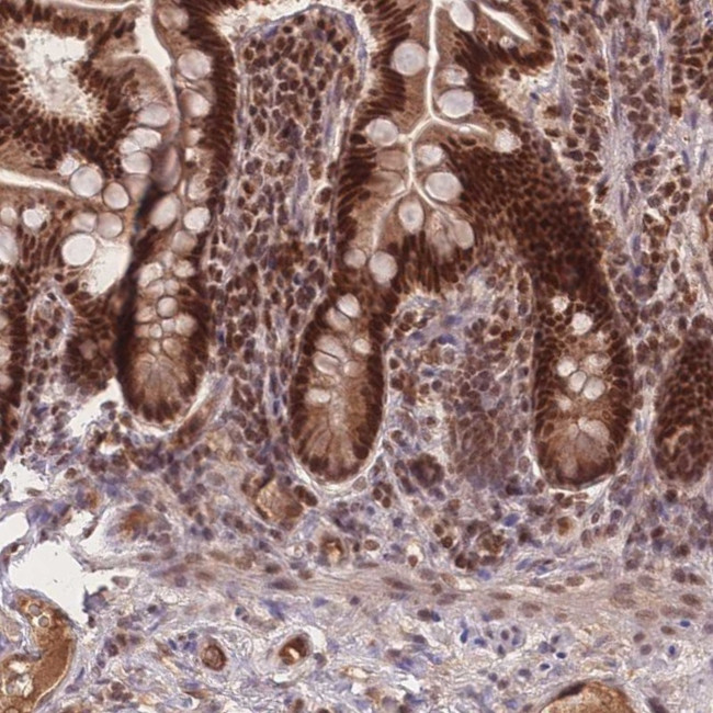 RAVER1 Antibody in Immunohistochemistry (IHC)