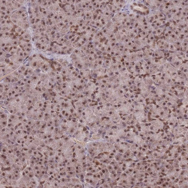 RAVER1 Antibody in Immunohistochemistry (IHC)