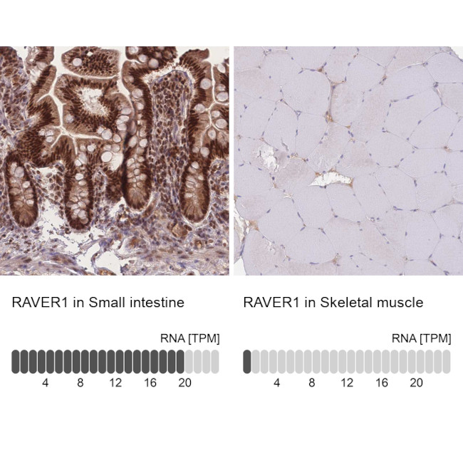 RAVER1 Antibody