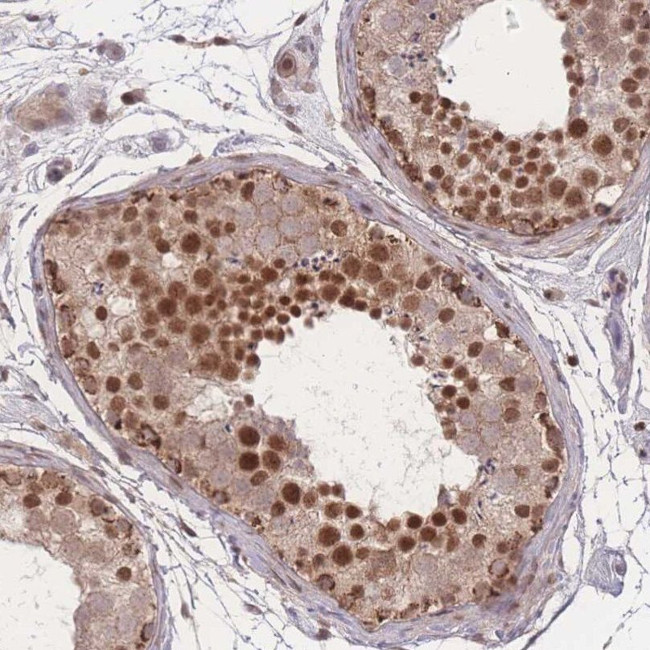 RAVER1 Antibody in Immunohistochemistry (IHC)