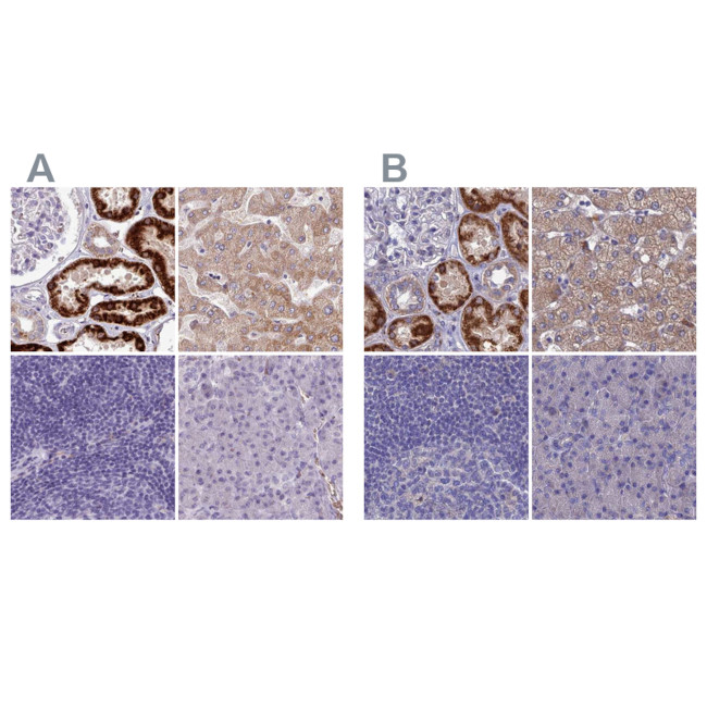 Adenylate Kinase 4 Antibody in Immunohistochemistry (IHC)