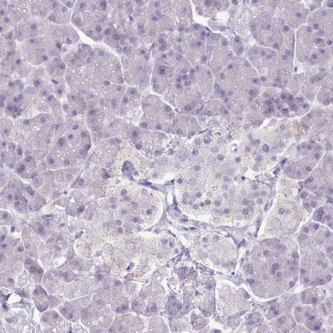 Adenylate Kinase 4 Antibody in Immunohistochemistry (IHC)