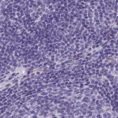 Adenylate Kinase 4 Antibody in Immunohistochemistry (IHC)