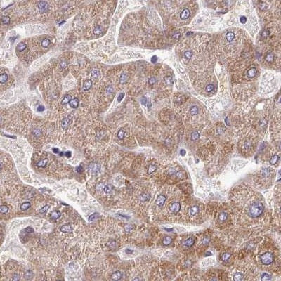 Adenylate Kinase 4 Antibody in Immunohistochemistry (IHC)