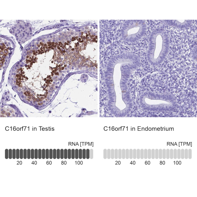 C16orf71 Antibody in Immunohistochemistry (IHC)