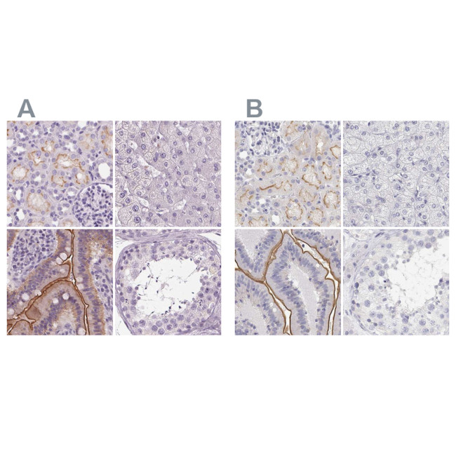 C19orf21 Antibody in Immunohistochemistry (IHC)