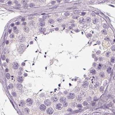 C19orf21 Antibody in Immunohistochemistry (IHC)