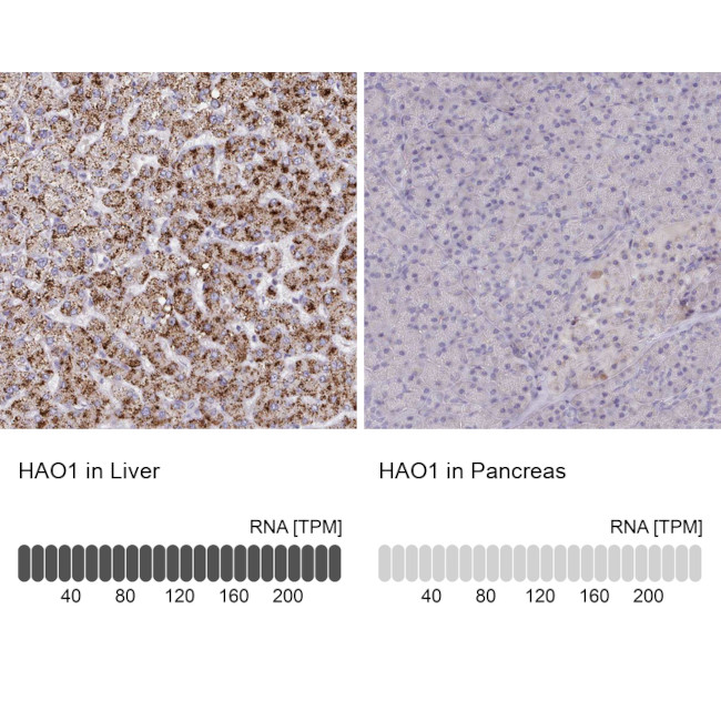 HAO1 Antibody in Immunohistochemistry (IHC)