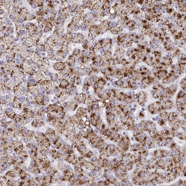 HAO1 Antibody in Immunohistochemistry (IHC)