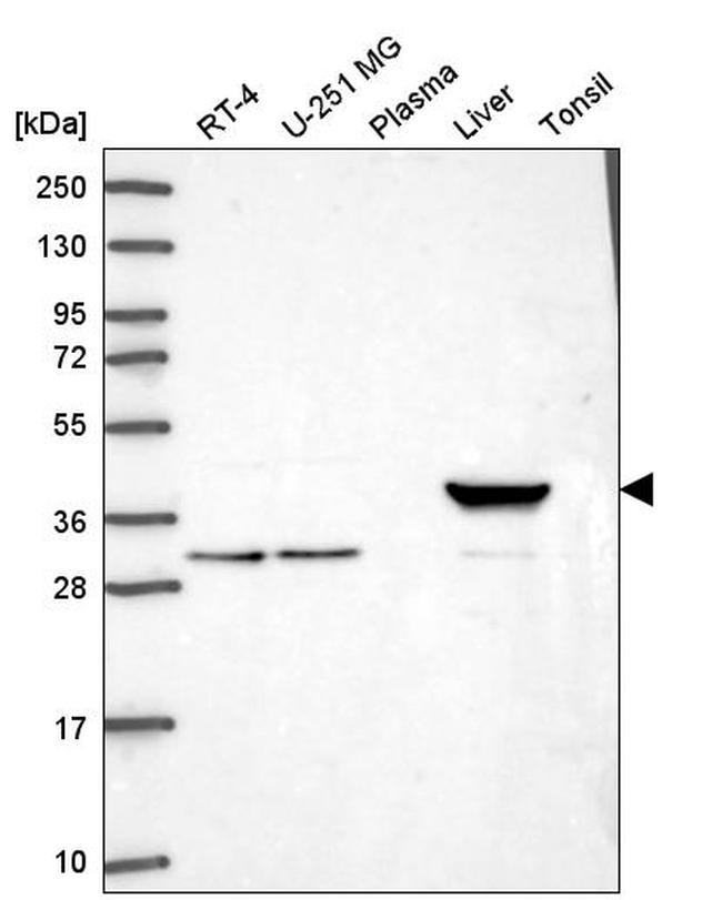 HAO1 Antibody in Western Blot (WB)