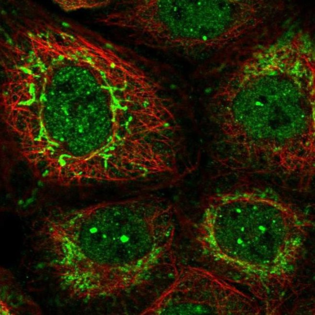 PUS10 Antibody in Immunocytochemistry (ICC/IF)