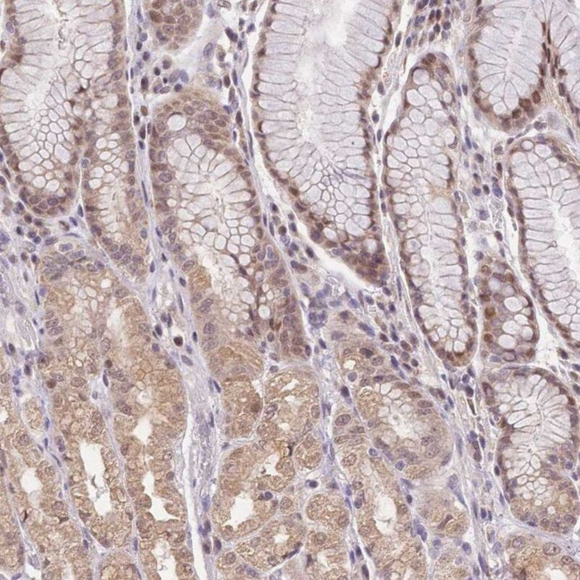 PUS10 Antibody in Immunohistochemistry (IHC)