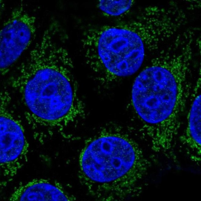 ABHDB Antibody in Immunocytochemistry (ICC/IF)