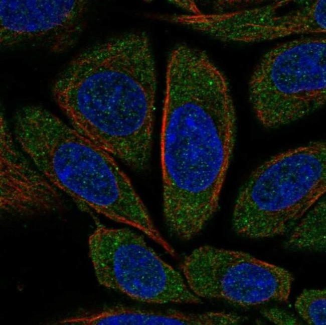 CNOT1 Antibody in Immunocytochemistry (ICC/IF)