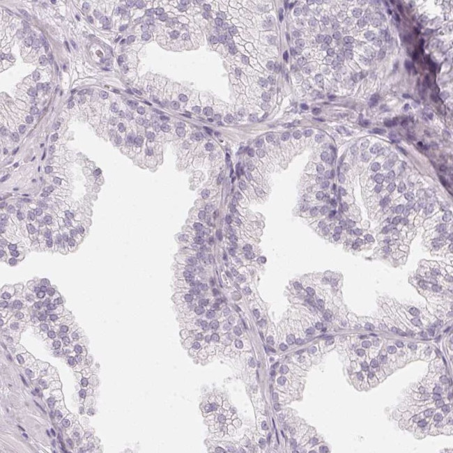 C1orf194 Antibody in Immunohistochemistry (IHC)