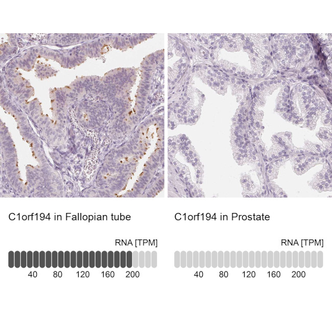 C1orf194 Antibody