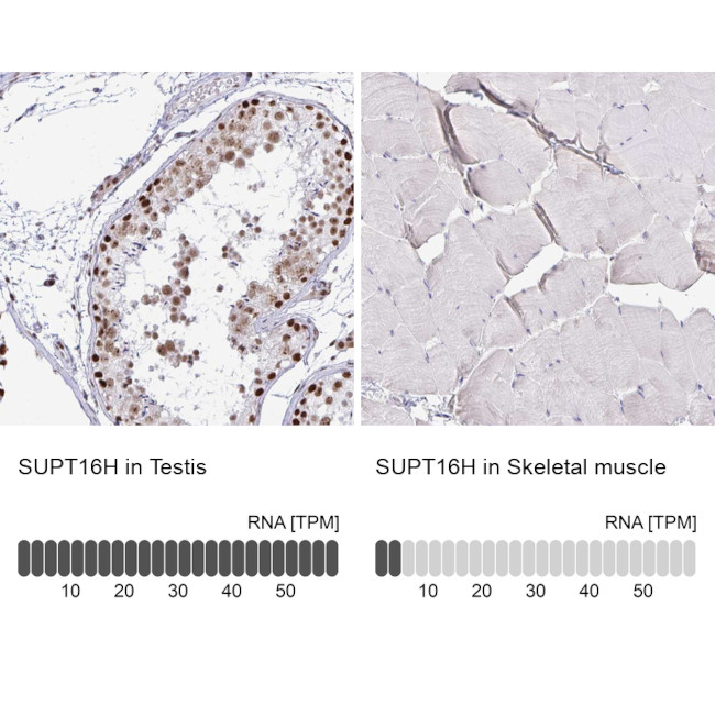 SUPT16H Antibody in Immunohistochemistry (IHC)