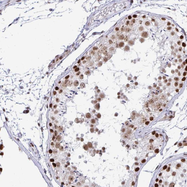 SUPT16H Antibody in Immunohistochemistry (IHC)