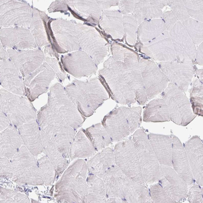 SUPT16H Antibody in Immunohistochemistry (IHC)