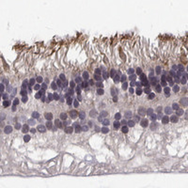 R9BP Antibody in Immunohistochemistry (IHC)