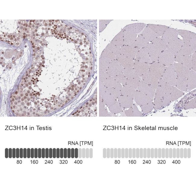 ZC3H14 Antibody in Immunohistochemistry (IHC)