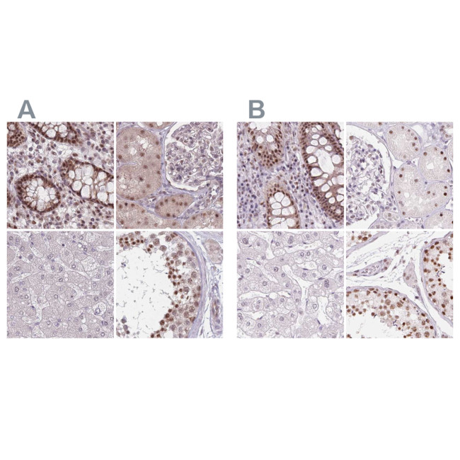 ZC3H14 Antibody in Immunohistochemistry (IHC)